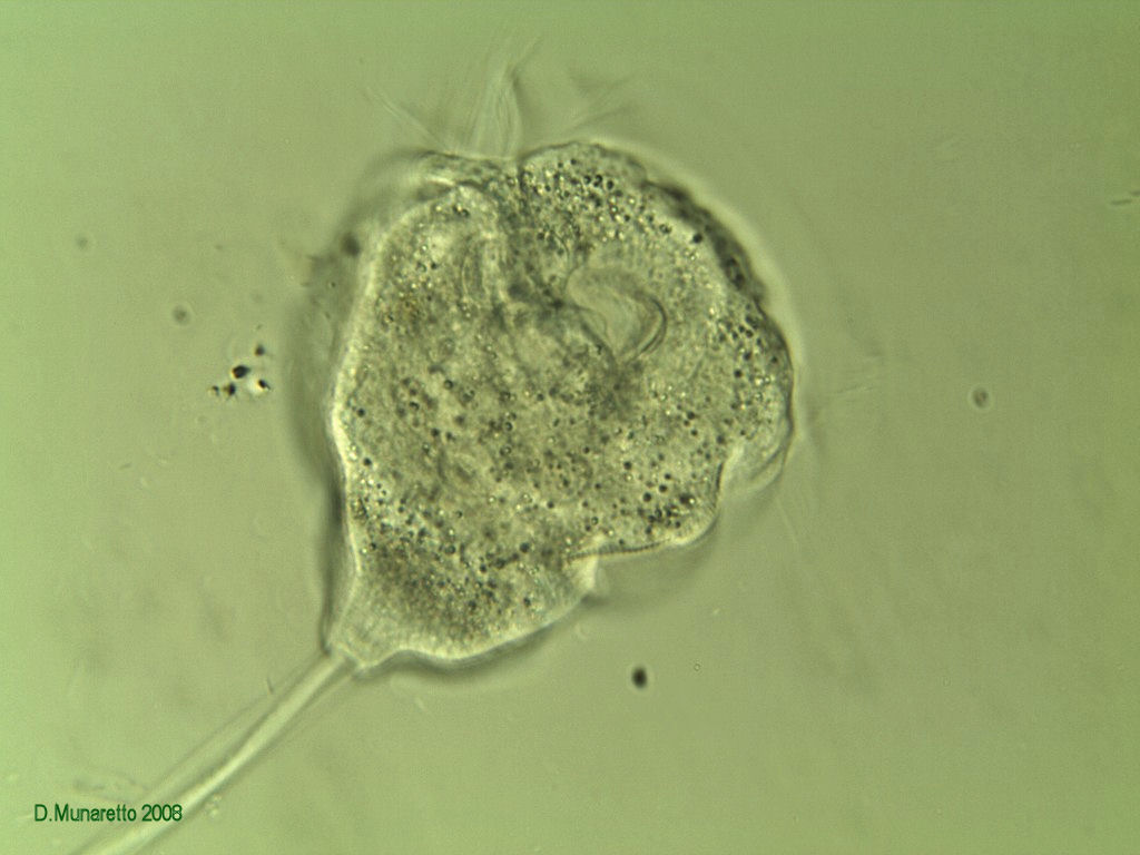 Rieccomi...con Vorticella Gigante a 400x !